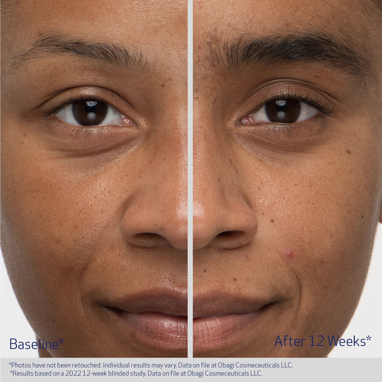 Obagi Nu-Cil® Eyebrow Boosting Serum