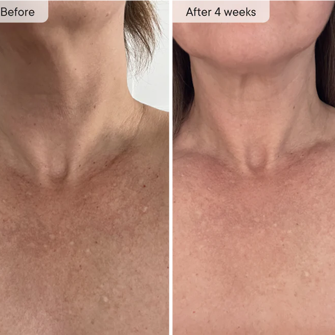Neck & Décolletage LED System Red Light Neck & Chest Mask