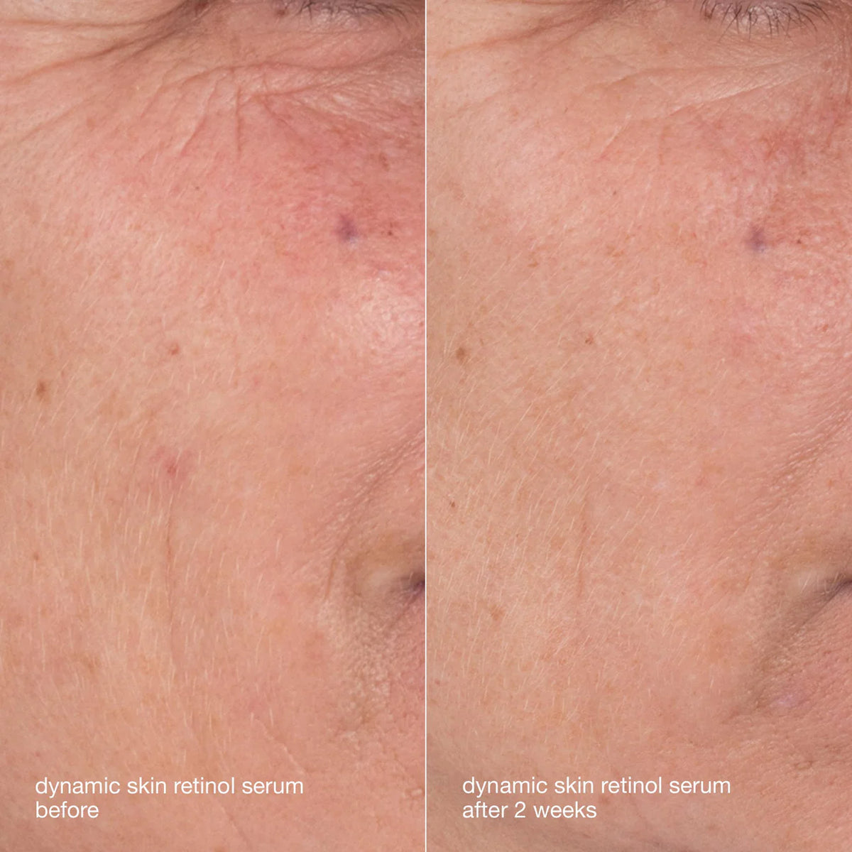 Skin Aging Solutions Kit