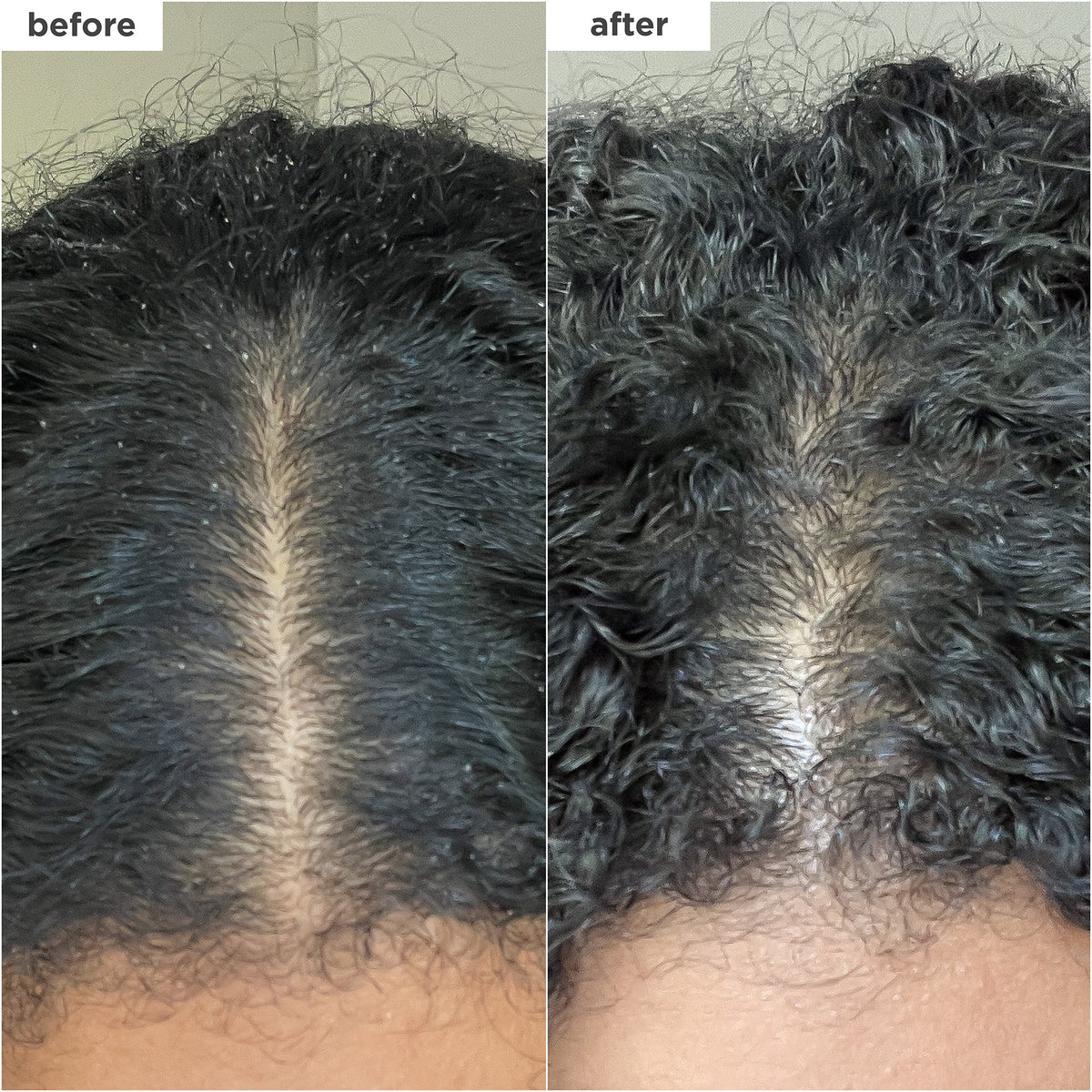 Scalp Revival Charcoal + Coconut Oil Micro-Exfoliating Shampoo
