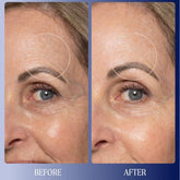 Before and after comparison of a woman&