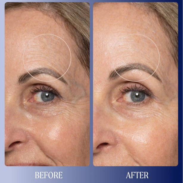 Before and after comparison of a woman&