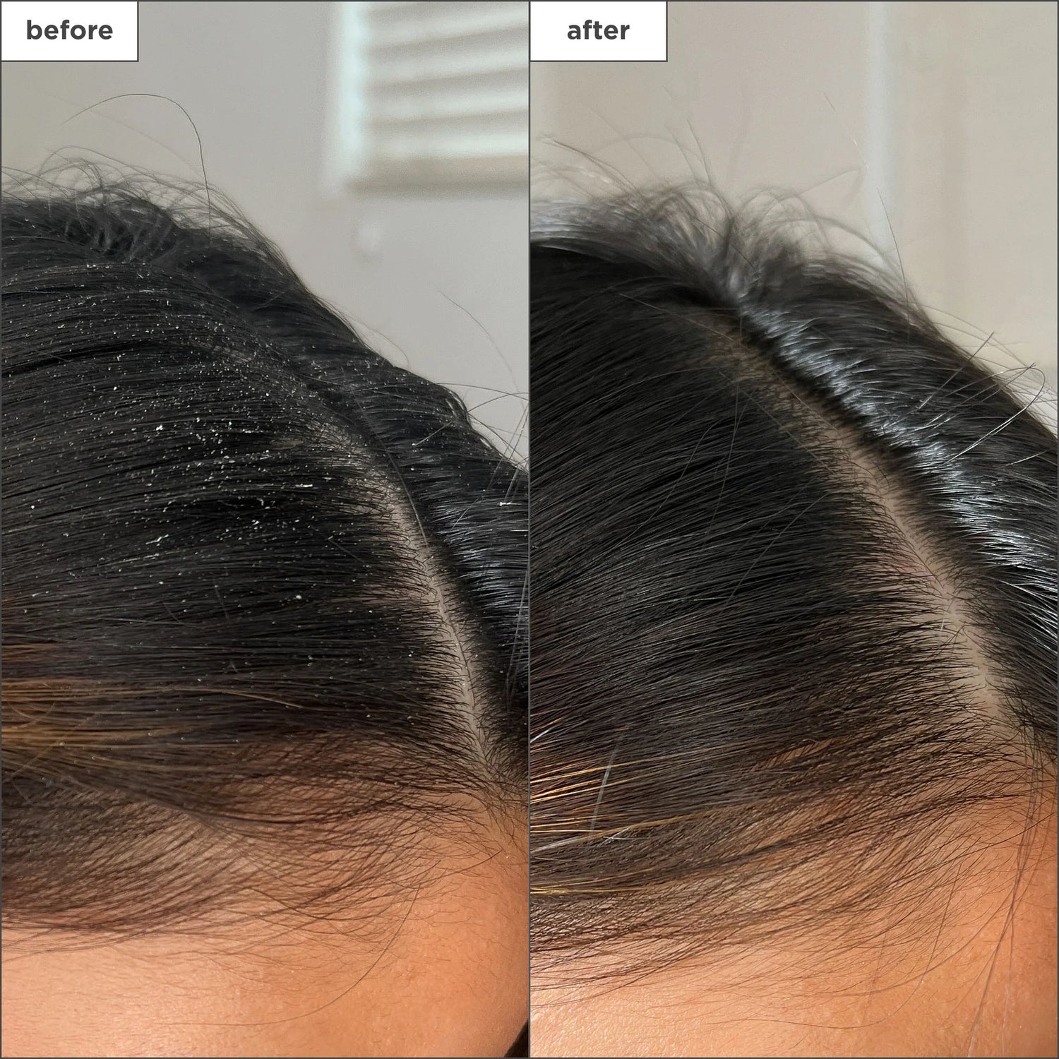 Scalp Revival Charcoal + Tea Tree Detox Spray