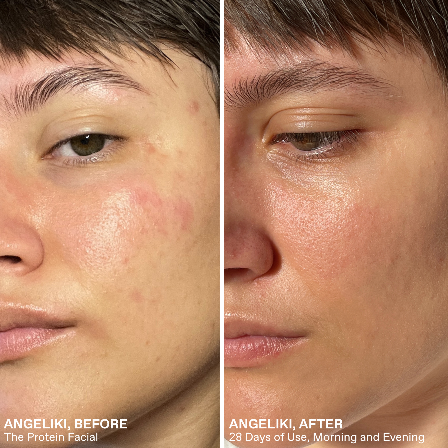 Protein Facial Kit ($155 Value)