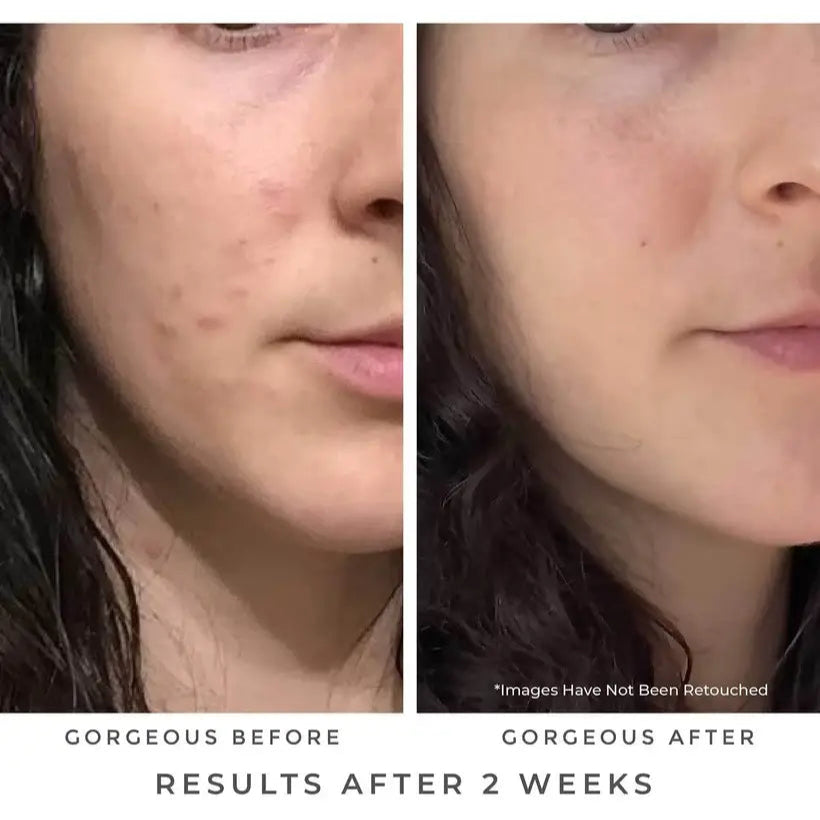 OASIS Deep Pore Gel Cleanser: Chlorophyll + Botanical BHA