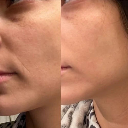 Corners of Eyes &amp; Mouth Facial Patches