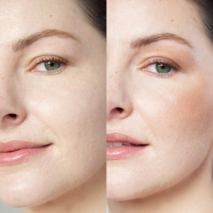 Rice Powder Blush &amp; Bronzer