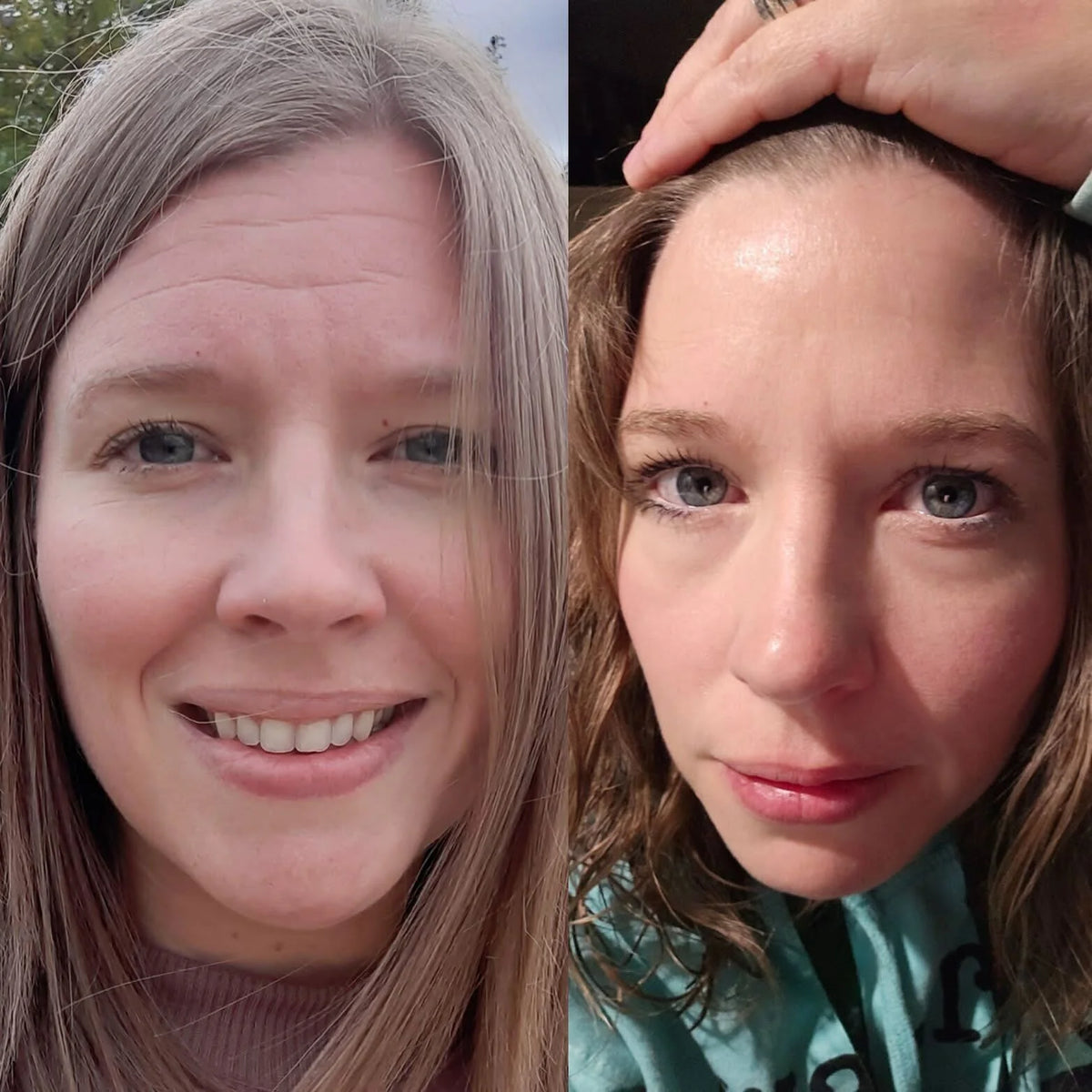 Forehead &amp; Between the Eyes Facial Patches