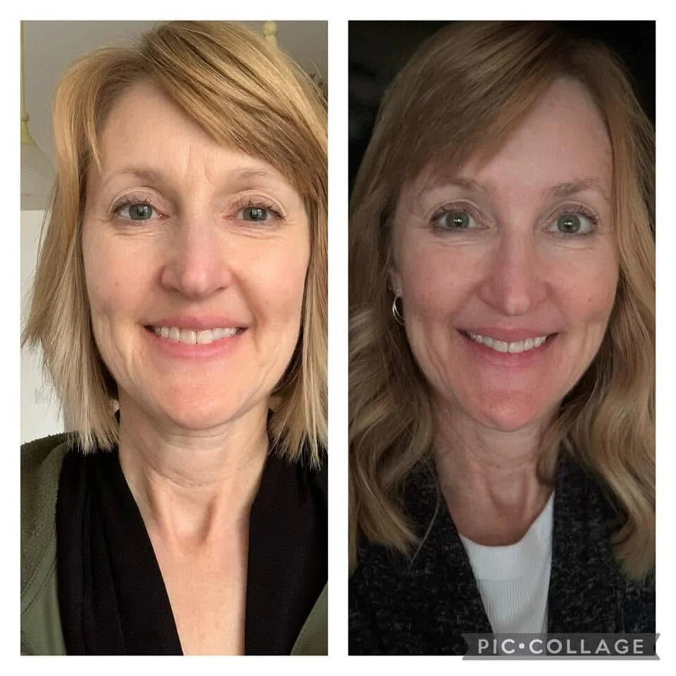Forehead &amp; Between the Eyes Facial Patches