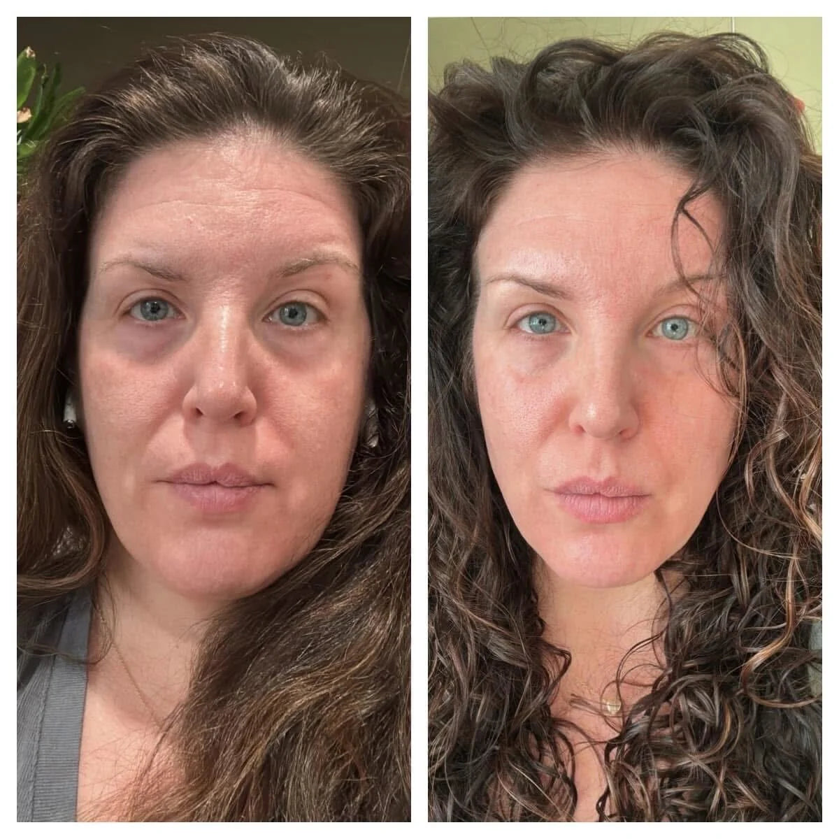 Forehead &amp; Between the Eyes Facial Patches