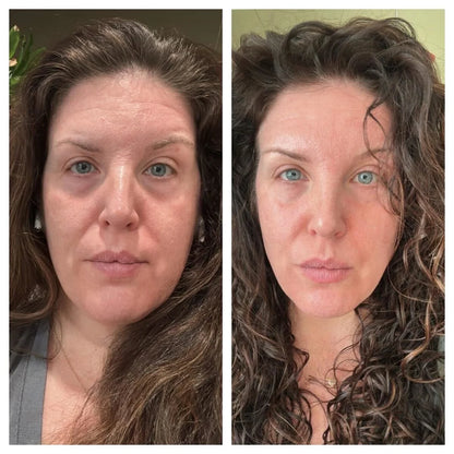 Forehead &amp; Between the Eyes Facial Patches