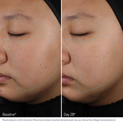 CLENZIDERM M.D.® Pore Therapy Exfoliating BHA Toner