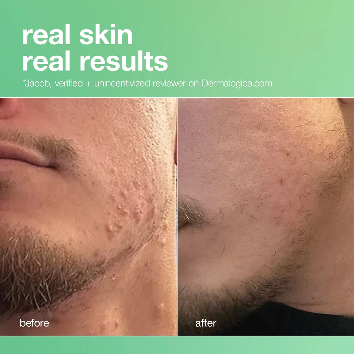 Breakout Clearing Foaming Wash