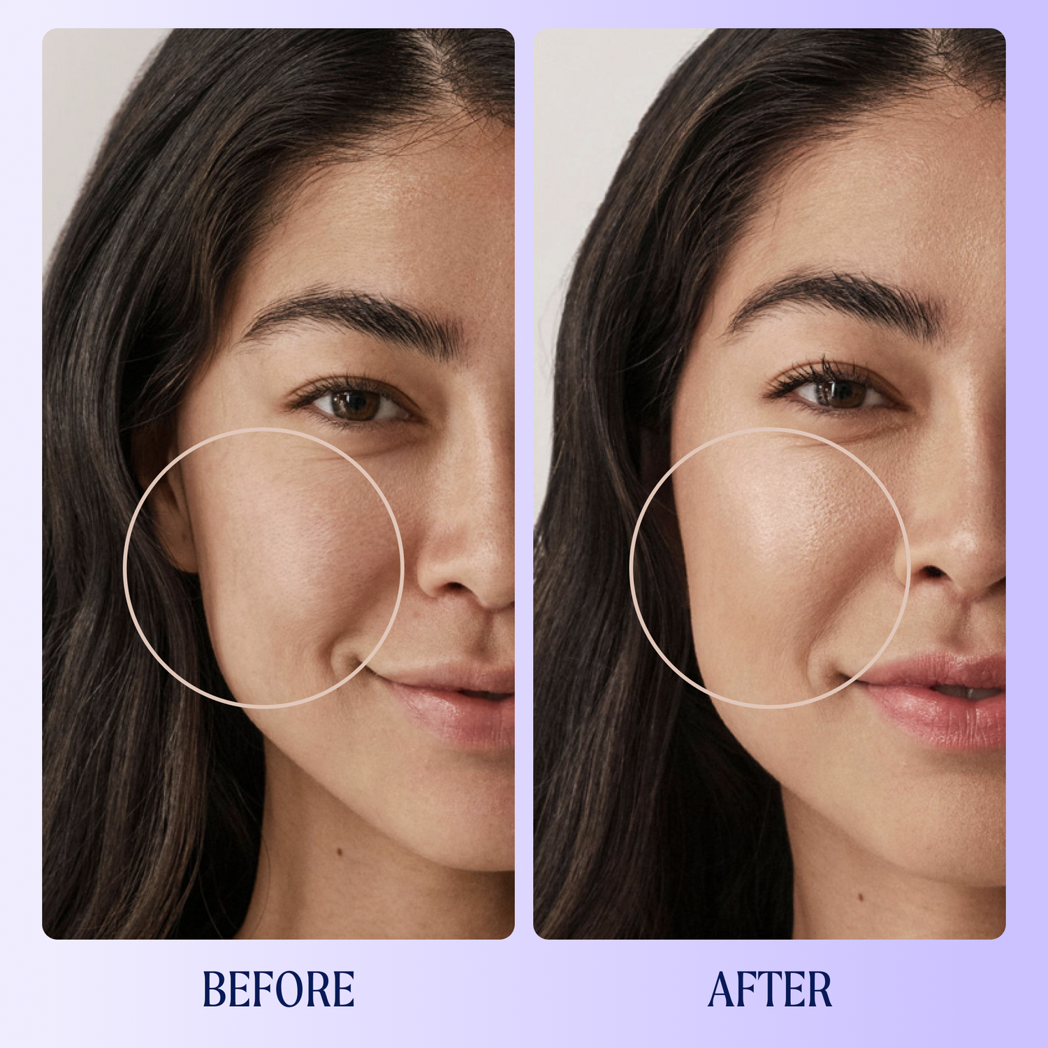 Self Reflect Probiotic Sunscreen Zinc Oxide SPF 32