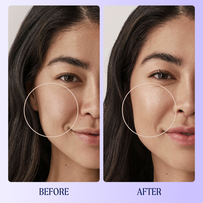 Self Reflect Probiotic Sunscreen Zinc Oxide SPF 32