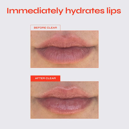 Lip Jelly
